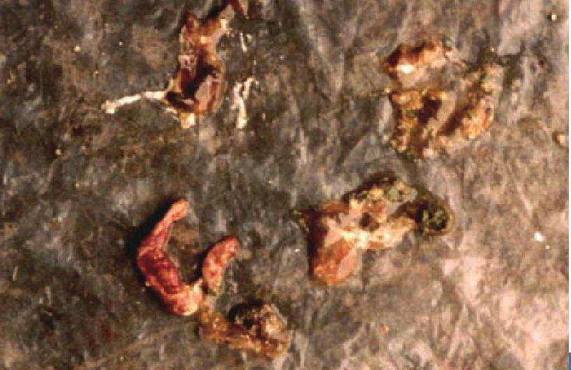 鵝球蟲病 鵝球蟲病